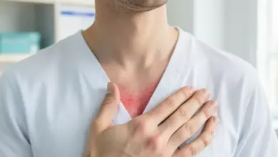 co je Tietzův syndrom a jak ho léčit - Co je tietzův syndrom a - ilustrační foto