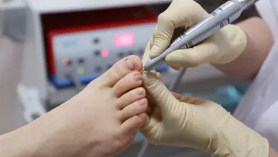 Léčení kuří oka u dítěte pomocí elektrického pilníku