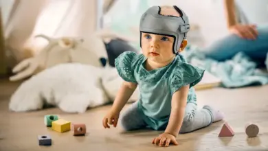 Dítě s korekčním helmem pro plagiocéfalii sedí na podlaze.
